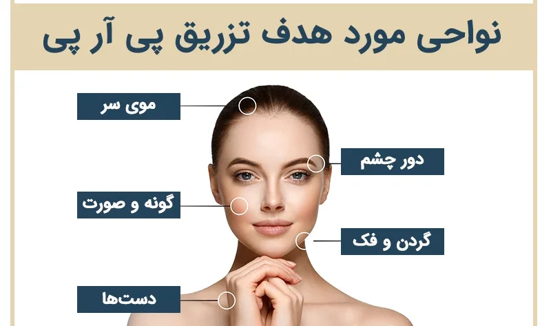 پی آر پی